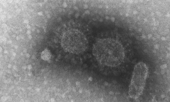 coronavirus