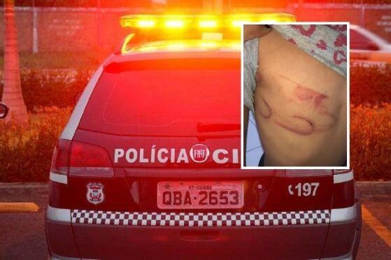 CRIANÇA AGREDIDA PELOS PAIS SAPEZAL