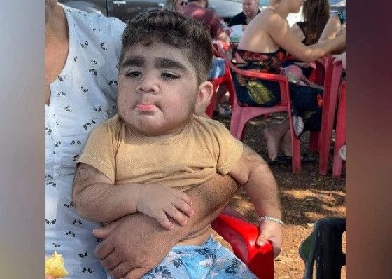 bebe com barba