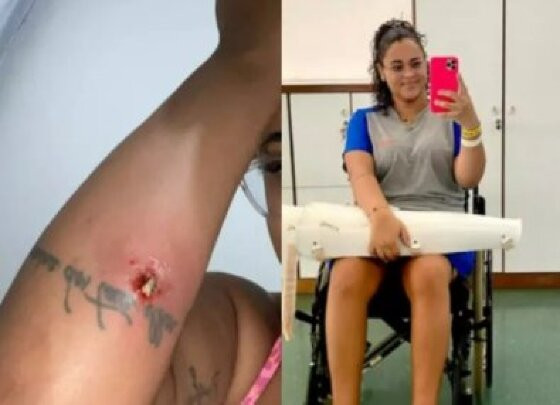 mulher de cadeira de rodas