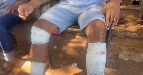 baleado são josé