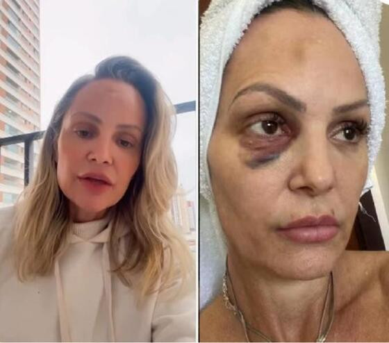 Débora Sander foi agredida pelo ex-namorado em agosto do ano passado.